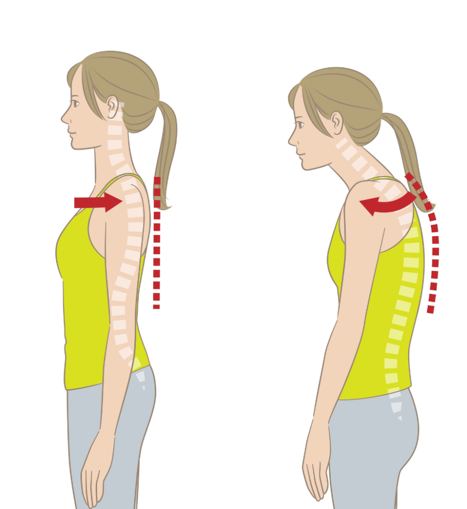 Illustration of poor posture with rounded shoulders vs. aligned posture.