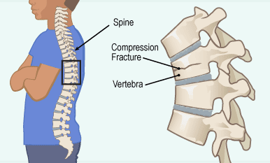 Spine1